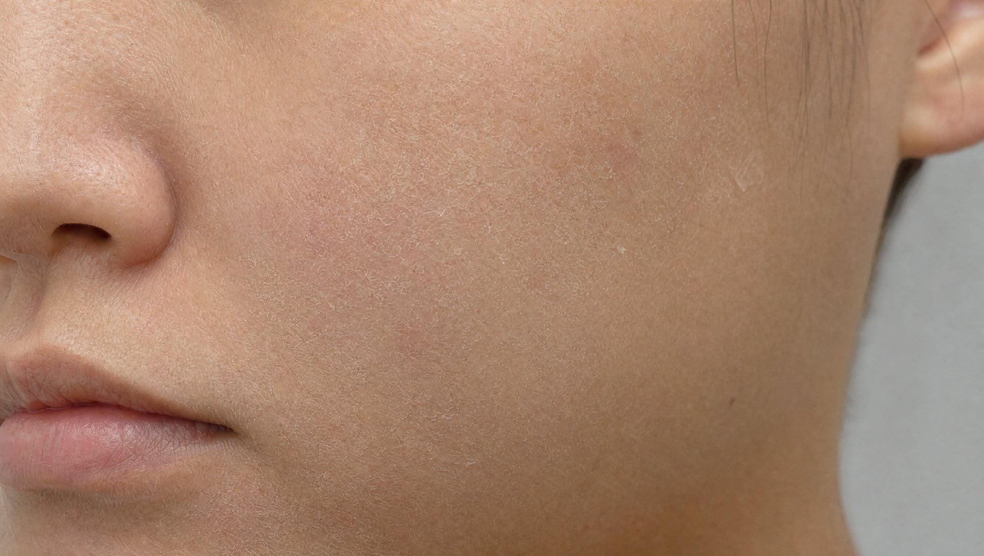 Skin that feels tight and stays dry