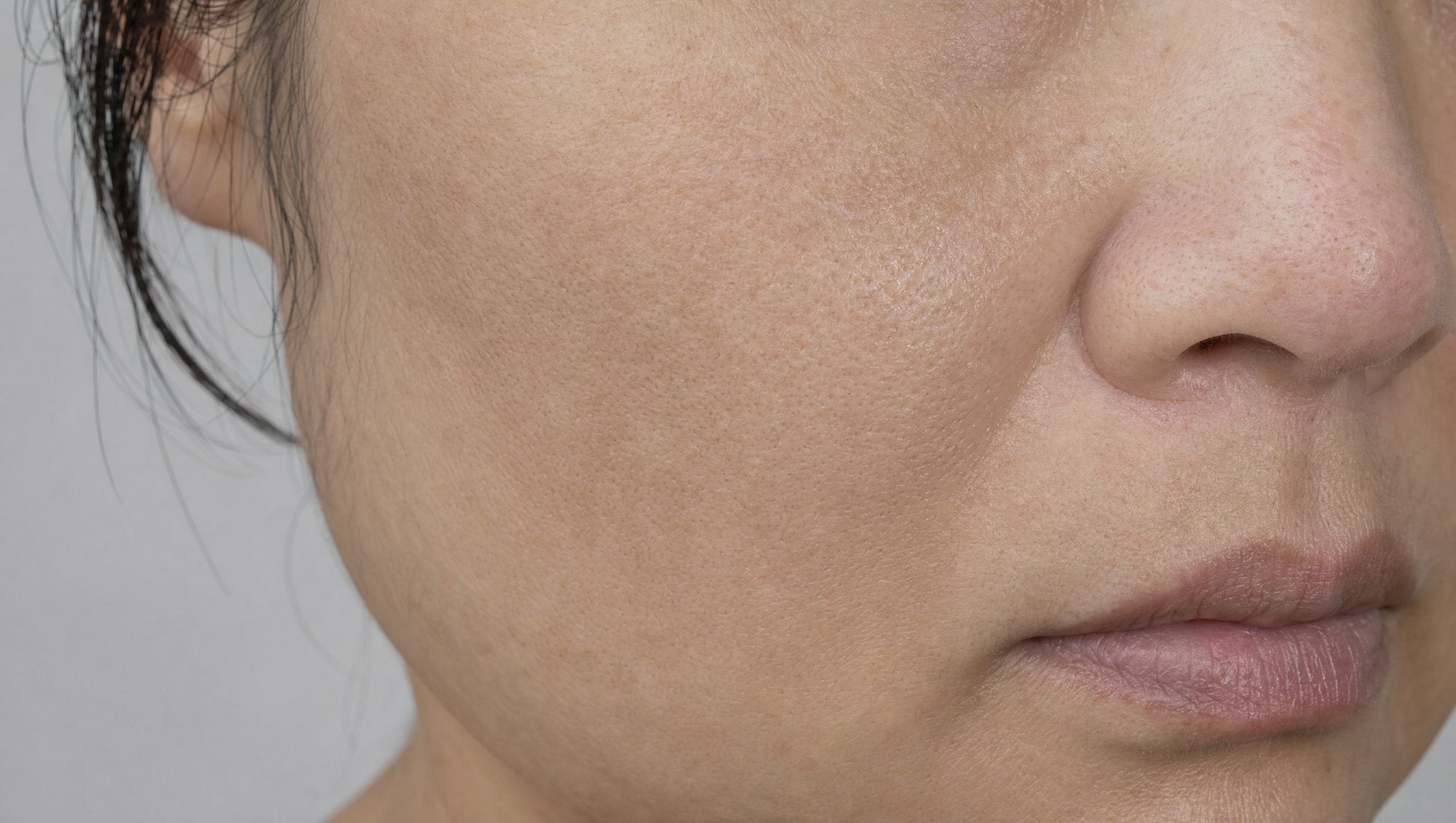 Visible pores and loss of firmness